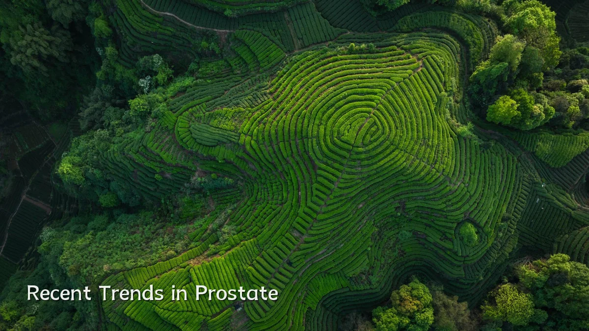 Recent Trends in Prostate