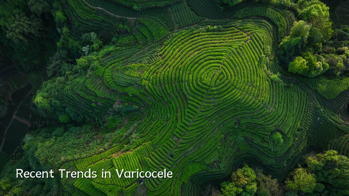 Recent Trends in Varicocele